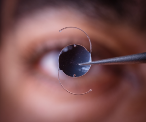 Lens Implant Surgery In Largo, FL