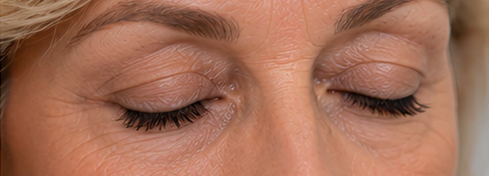 Close-up of closed eyes showing upper eyelid skin