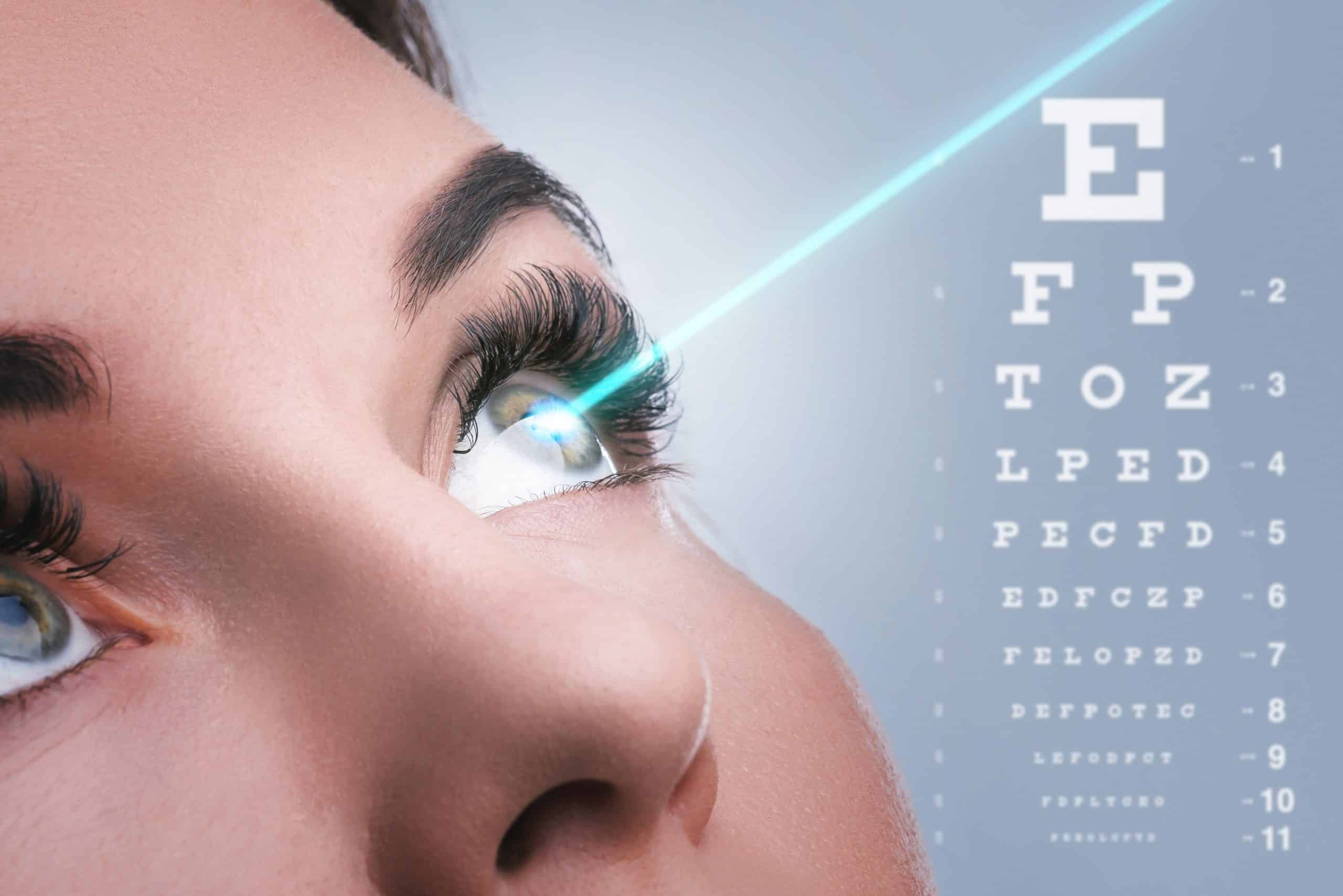 Woman has laser eye surgery to correct her myopia for improved vision with LASIK